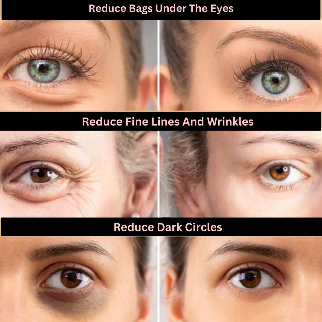 Lumina Eyebag Removal Cream ✨